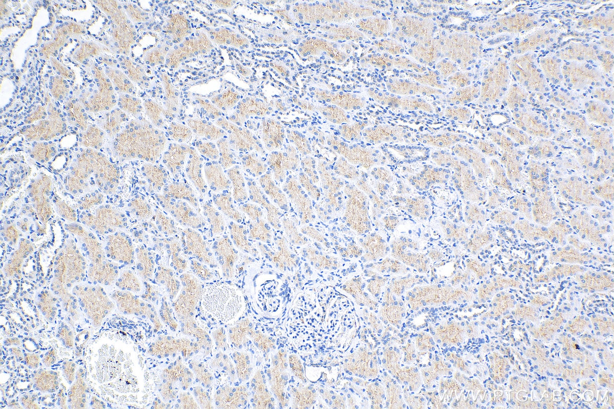 IHC staining of human kidney using 23247-1-AP