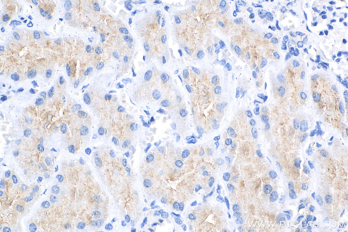 Immunohistochemistry (IHC) staining of human kidney tissue using IFIT1 Polyclonal antibody (23247-1-AP)