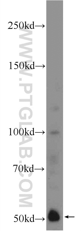 IFIT1 Polyclonal antibody