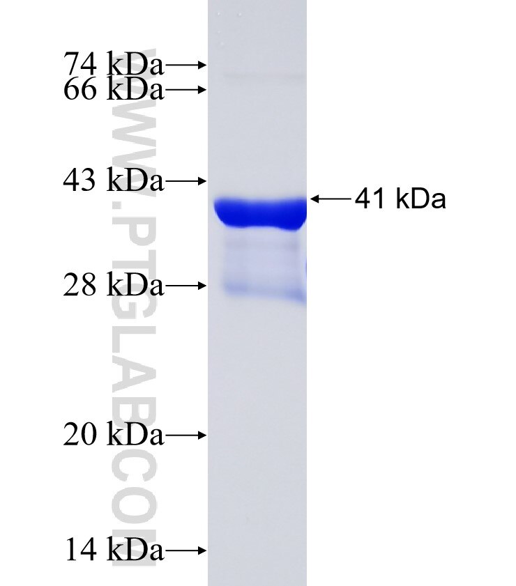 IFIT1 fusion protein Ag19445 SDS-PAGE