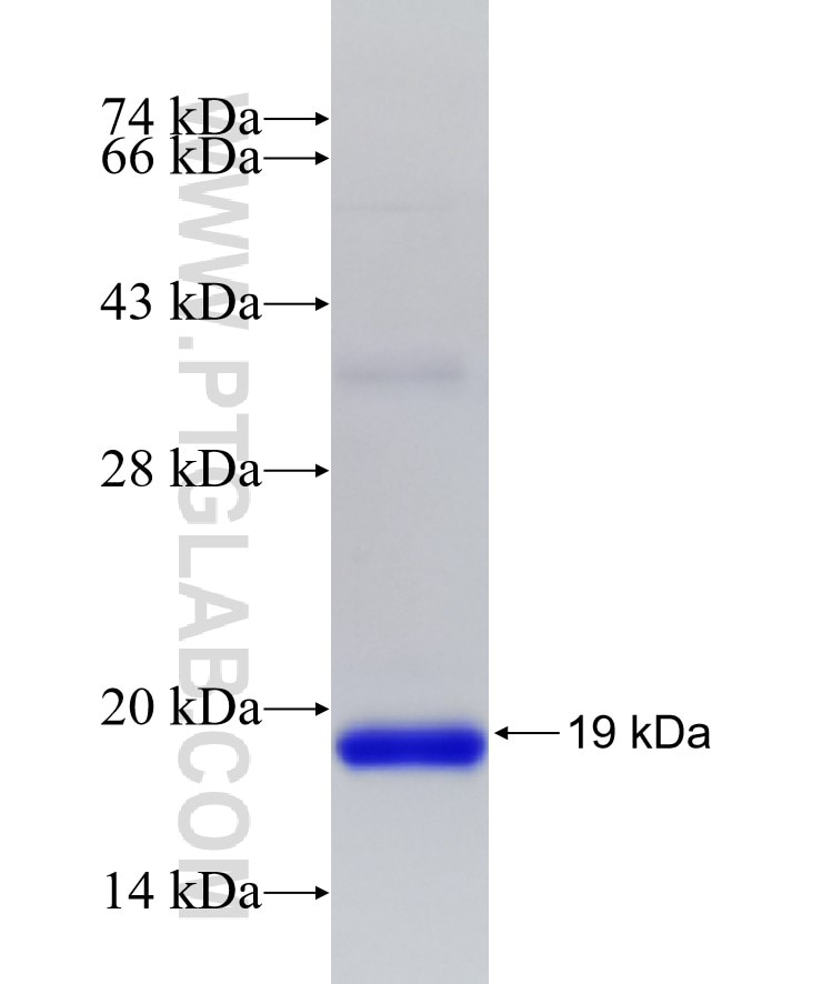 IFIT1 fusion protein Ag19691 SDS-PAGE