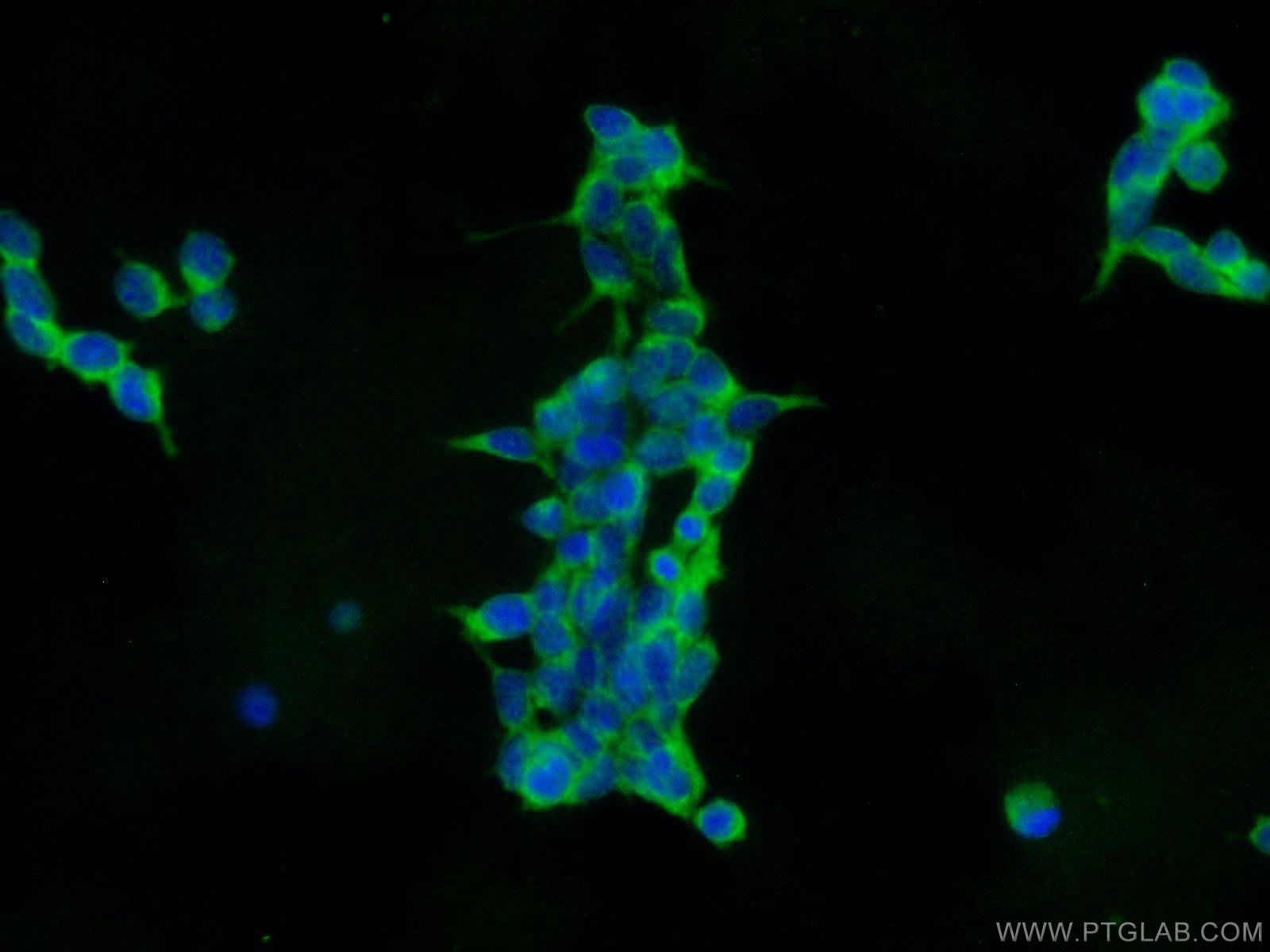 Immunofluorescence (IF) / fluorescent staining of HEK-293 cells using IFIT1L Polyclonal antibody (21483-1-AP)