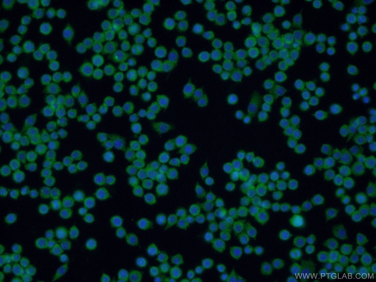 Immunofluorescence (IF) / fluorescent staining of RAW 264.7 cells using IFIT1L Polyclonal antibody (21483-1-AP)