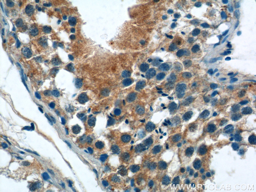 Immunohistochemistry (IHC) staining of human testis tissue using IFIT1L Polyclonal antibody (21483-1-AP)