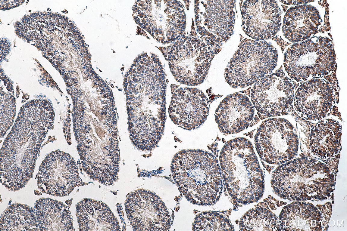 Immunohistochemistry (IHC) staining of mouse testis tissue using IFIT1L Polyclonal antibody (21483-1-AP)