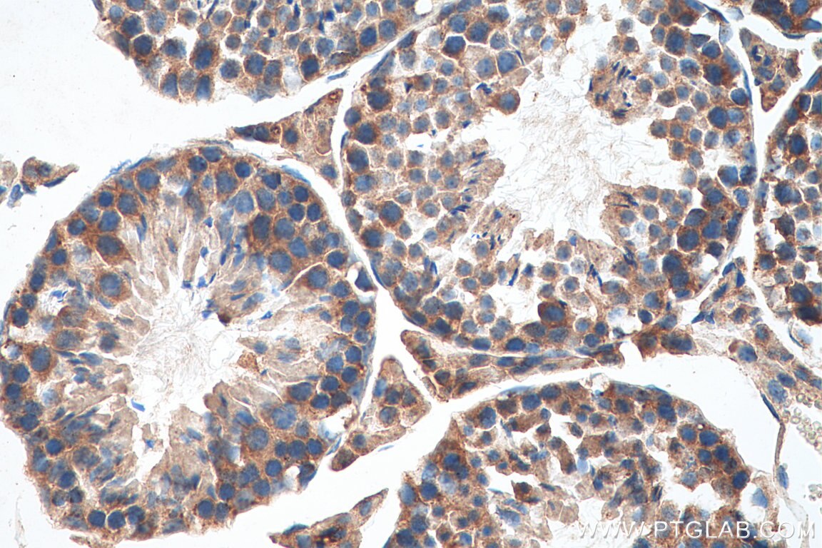Immunohistochemistry (IHC) staining of mouse testis tissue using IFIT1L Polyclonal antibody (21483-1-AP)