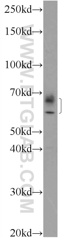 Western Blot (WB) analysis of RAW 264.7 cells using IFIT1L Polyclonal antibody (21483-1-AP)