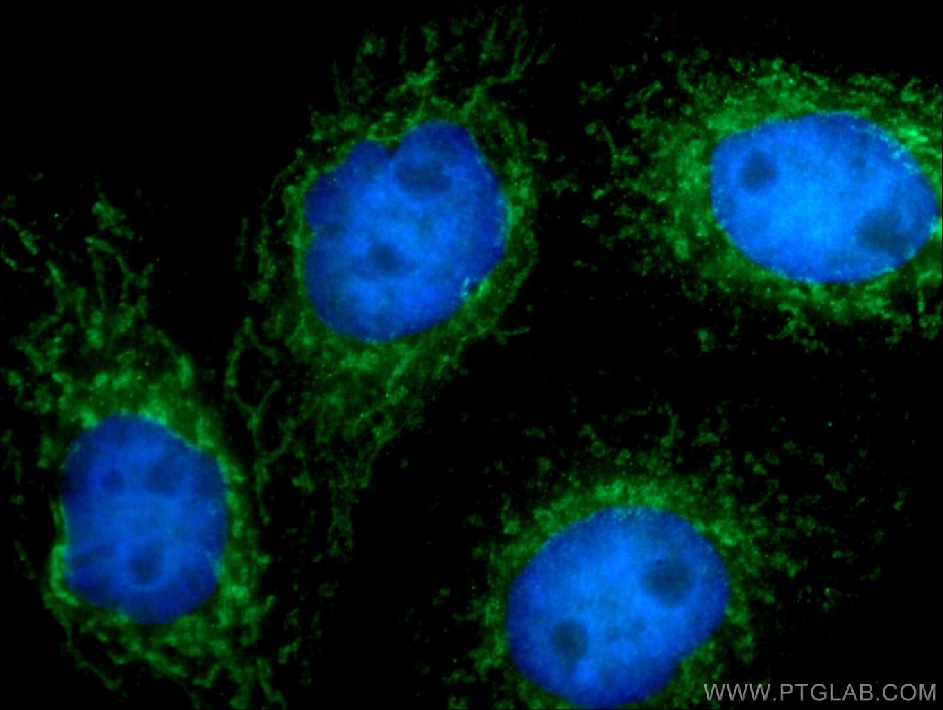 Immunofluorescence (IF) / fluorescent staining of HepG2 cells using IFIT2 Polyclonal antibody (12604-1-AP)