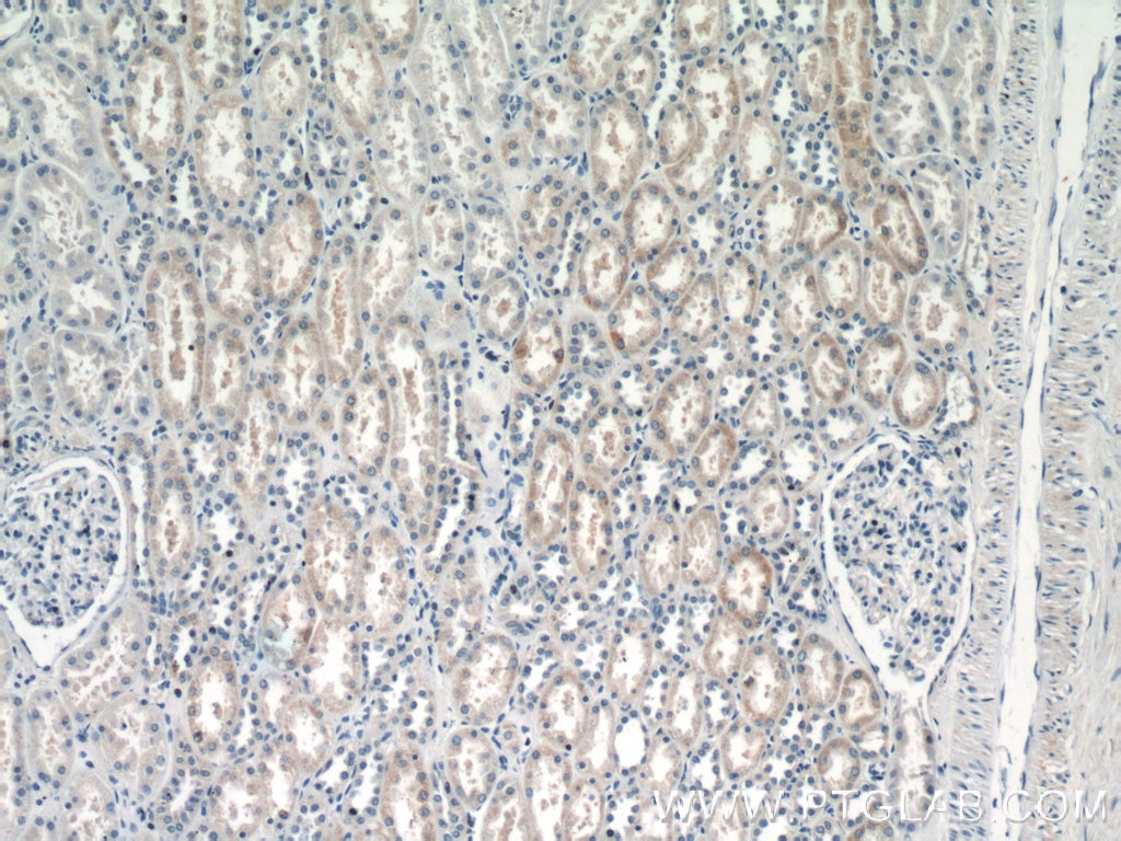 IHC staining of human kidney using 12604-1-AP