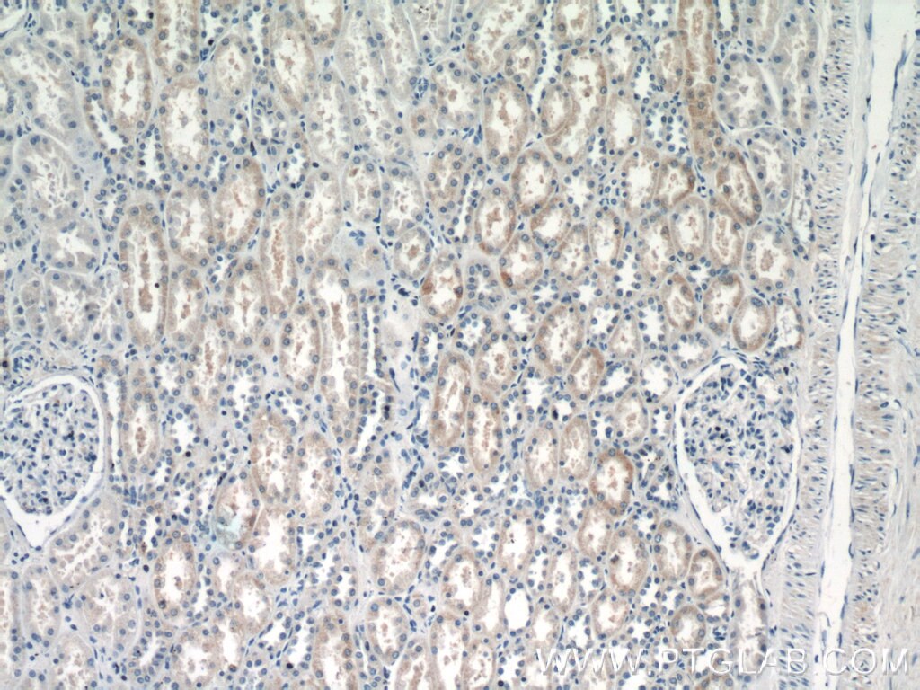 Immunohistochemistry (IHC) staining of human kidney tissue using IFIT2 Polyclonal antibody (12604-1-AP)