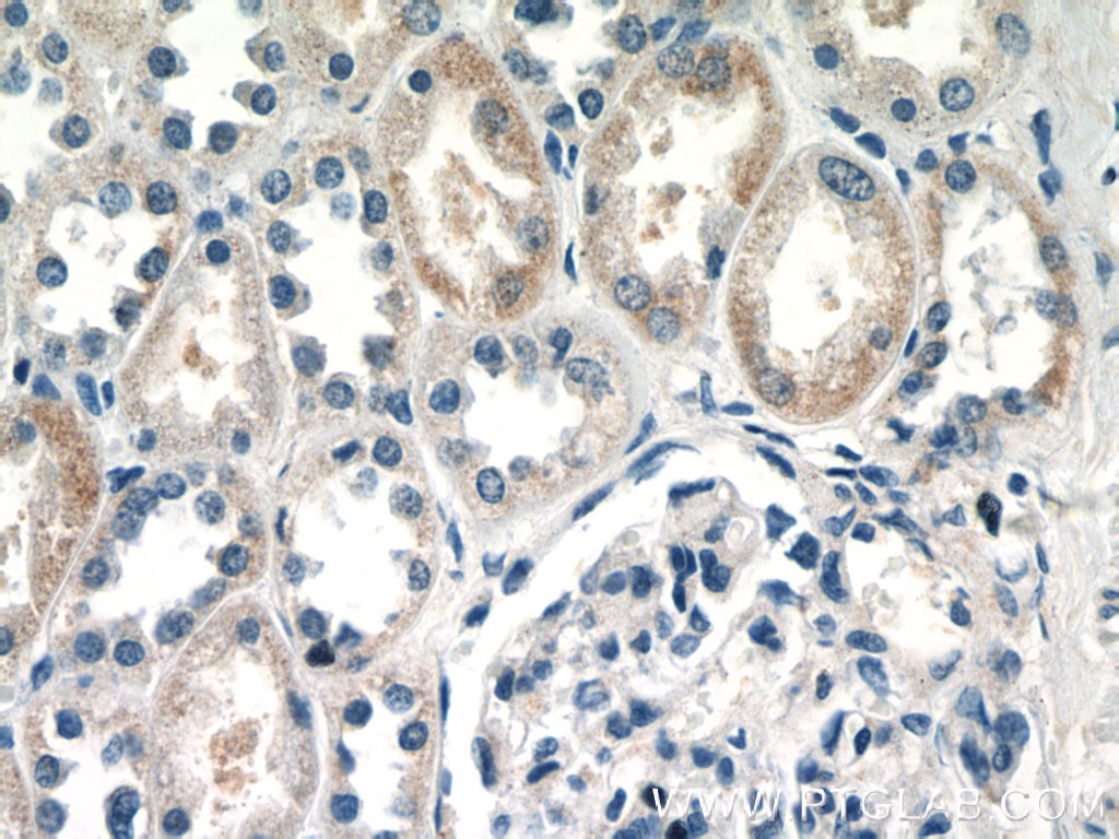 Immunohistochemistry (IHC) staining of human kidney tissue using IFIT2 Polyclonal antibody (12604-1-AP)