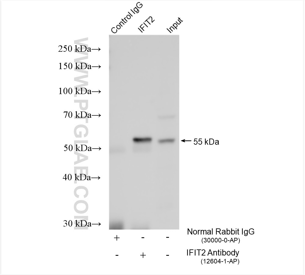 Immunoprecipitation (IP) experiment of A431 cells using IFIT2 Polyclonal antibody (12604-1-AP)
