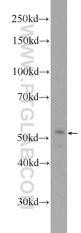 Western Blot (WB) analysis of A431 cells using IFIT2 Polyclonal antibody (12604-1-AP)