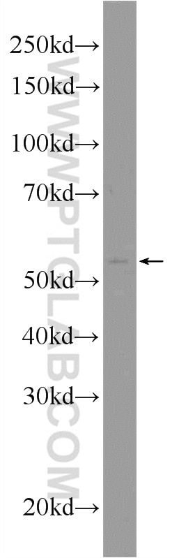 Western Blot (WB) analysis of RAW 264.7 cells using IFIT2 Polyclonal antibody (12604-1-AP)