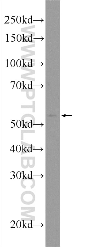 WB analysis of RAW 264.7 using 12604-1-AP