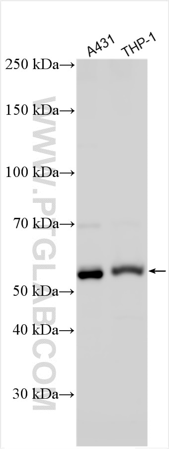 Western Blot (WB) analysis of various lysates using IFIT2 Polyclonal antibody (12604-1-AP)