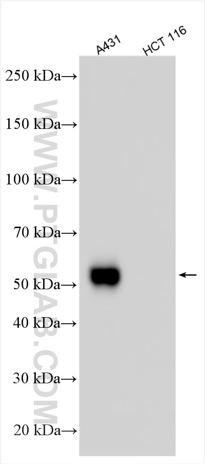 Western Blot (WB) analysis of various lysates using IFIT2 Polyclonal antibody (12604-1-AP)