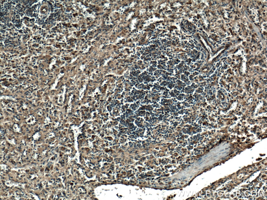 Immunohistochemistry (IHC) staining of human spleen tissue using IFIT3 Polyclonal antibody (15201-1-AP)