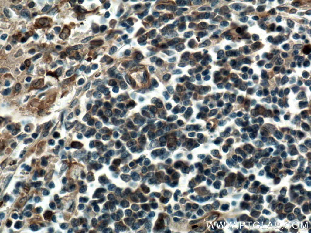 Immunohistochemistry (IHC) staining of human spleen tissue using IFIT3 Polyclonal antibody (15201-1-AP)