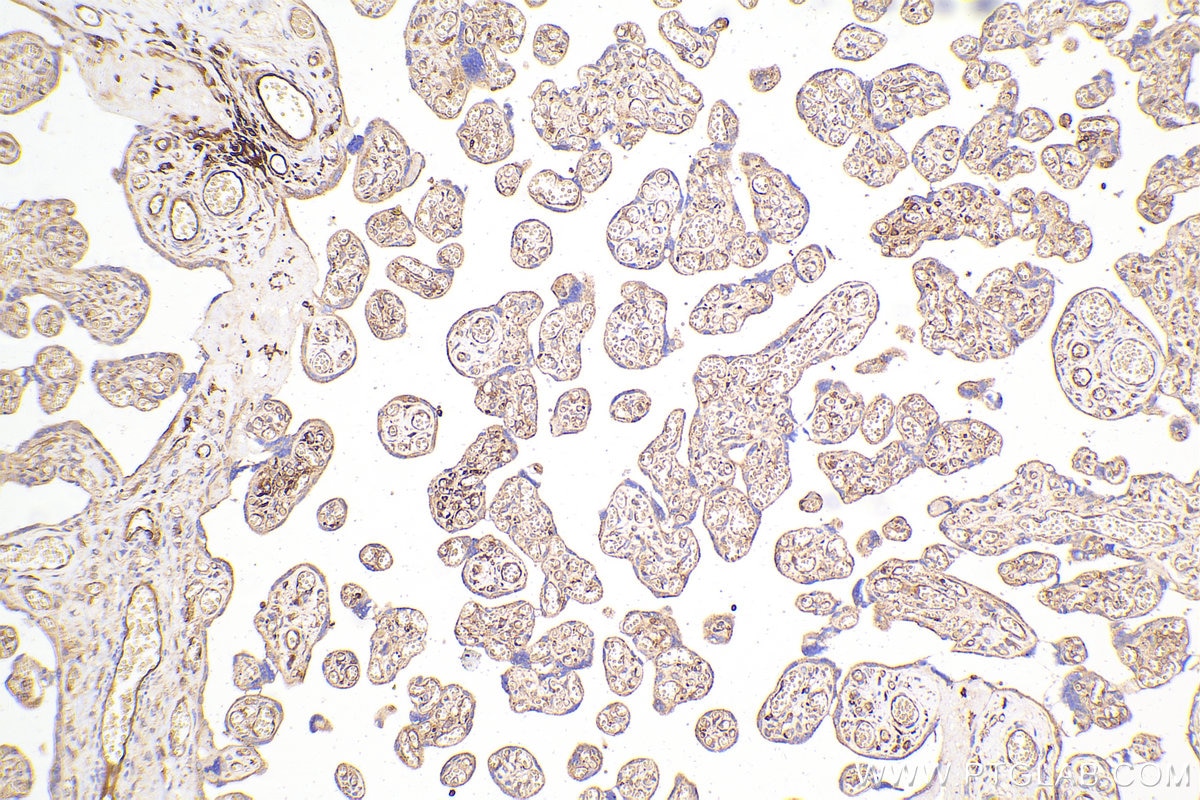 Immunohistochemistry (IHC) staining of human placenta tissue using IFIT3 Polyclonal antibody (15201-1-AP)