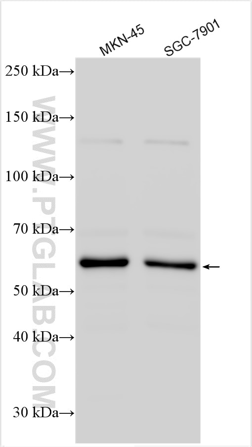 Western Blot (WB) analysis of various lysates using IFIT3 Polyclonal antibody (15201-1-AP)