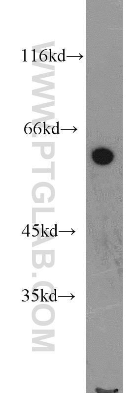 Western Blot (WB) analysis of HepG2 cells using IFIT3 Polyclonal antibody (15201-1-AP)
