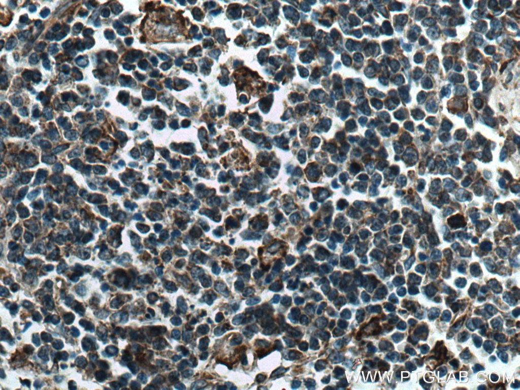 Immunohistochemistry (IHC) staining of human spleen tissue using IFIT3 Monoclonal antibody (67208-1-Ig)