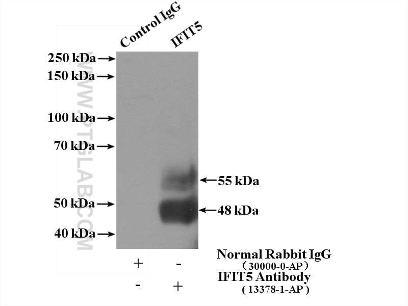 Immunoprecipitation (IP) experiment of A375 cells using IFIT5 Polyclonal antibody (13378-1-AP)