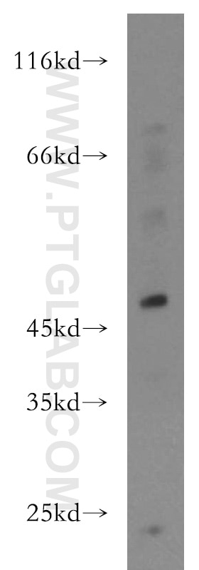 Western Blot (WB) analysis of A375 cells using IFIT5 Polyclonal antibody (13378-1-AP)