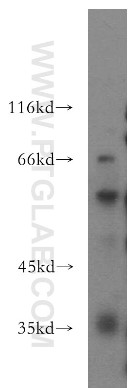 Western Blot (WB) analysis of PC-3 cells using IFIT5 Polyclonal antibody (13378-1-AP)