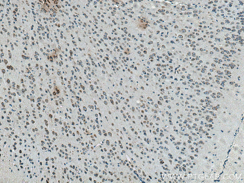 Immunohistochemistry (IHC) staining of mouse brain tissue using IFITM1 Polyclonal antibody (11727-3-AP)