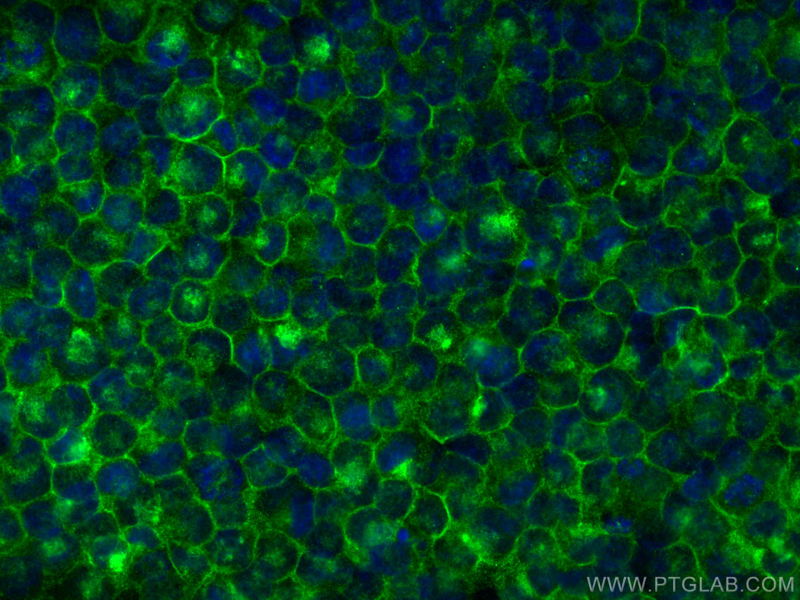 Immunofluorescence (IF) / fluorescent staining of K-562 cells using IFITM1-Specific Monoclonal antibody (60074-1-Ig)