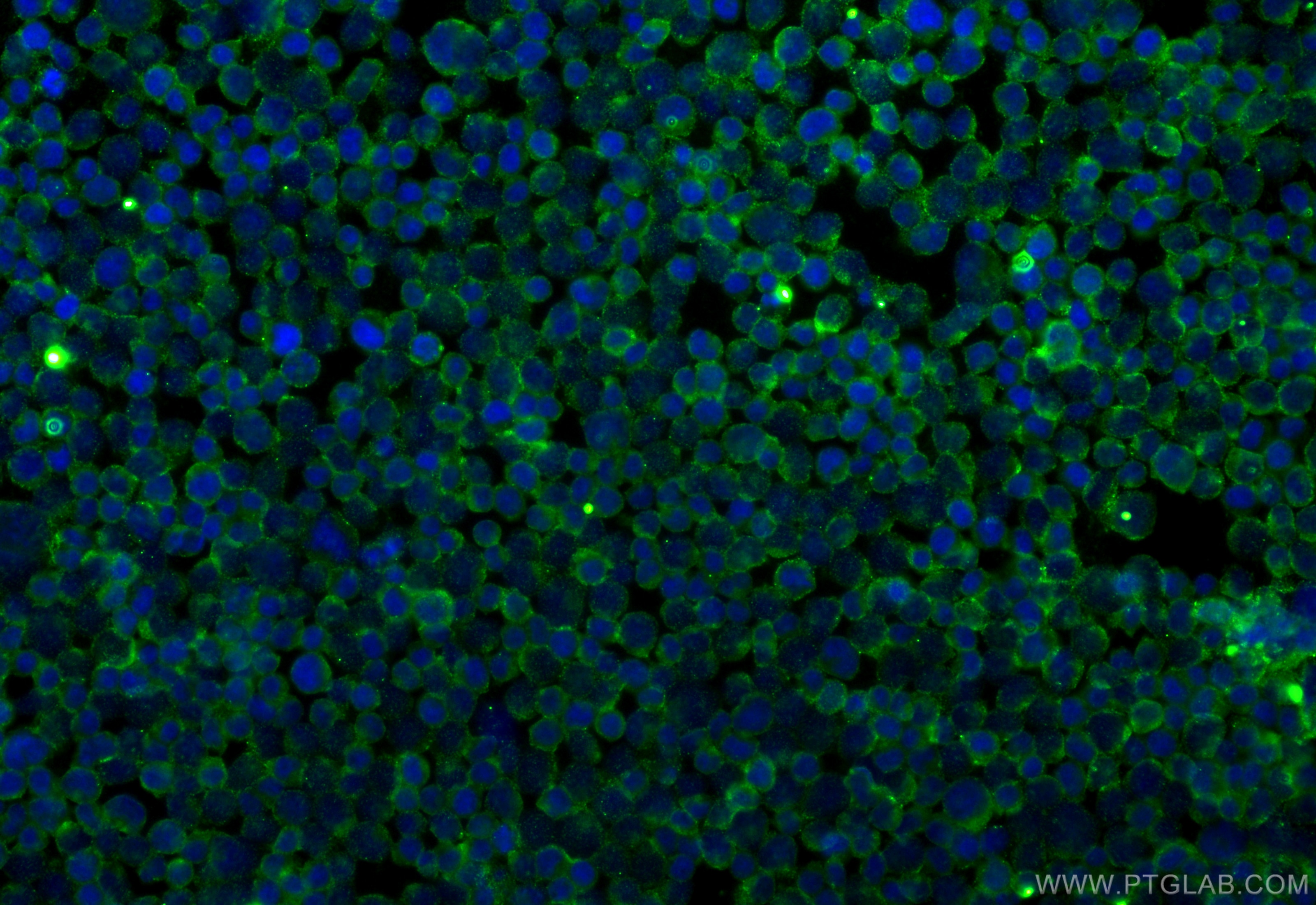 Immunofluorescence (IF) / fluorescent staining of Jurkat cells using IFITM1-Specific Monoclonal antibody (60074-1-Ig)