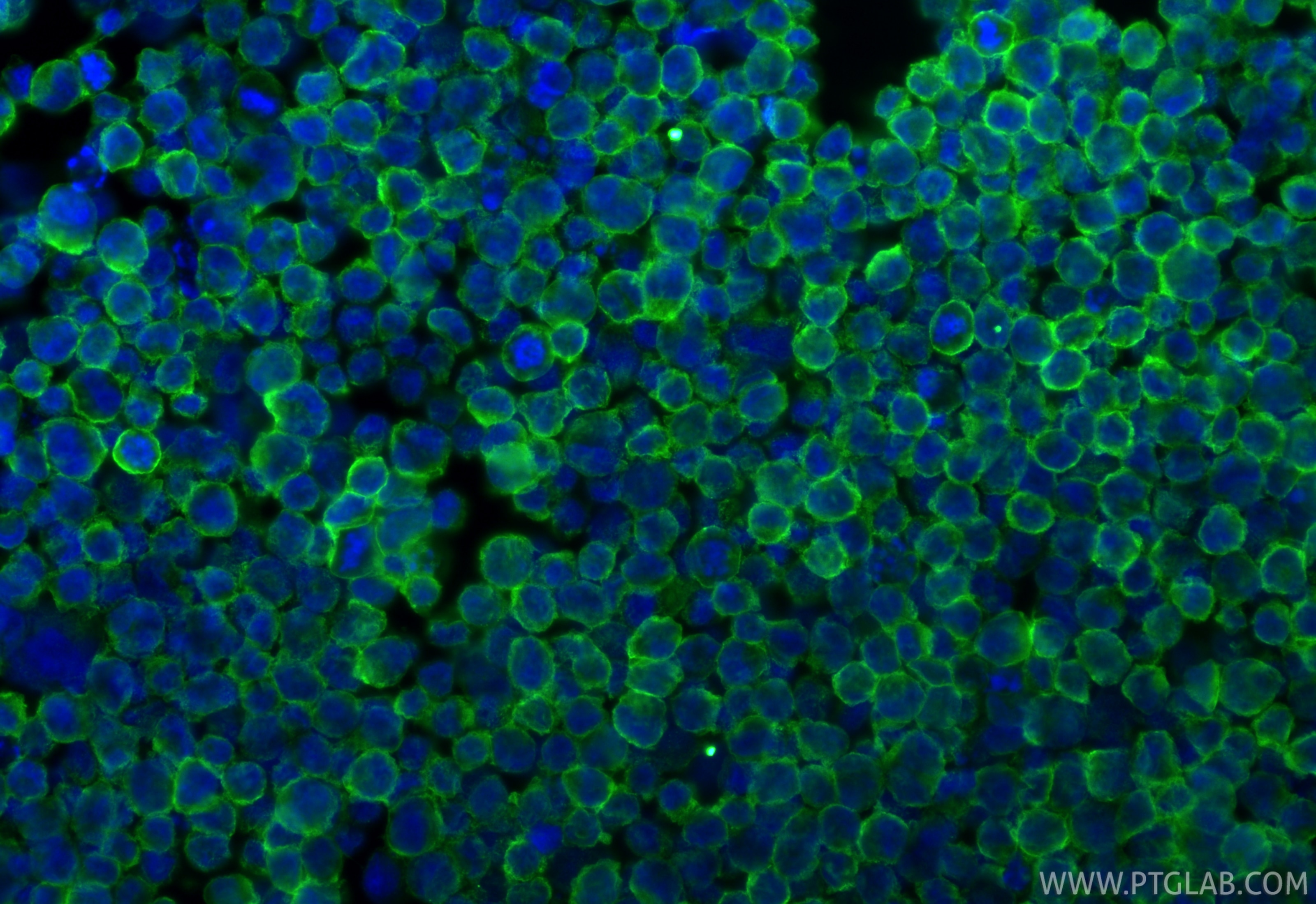 Immunofluorescence (IF) / fluorescent staining of K-562 cells using IFITM1-Specific Monoclonal antibody (60074-1-Ig)