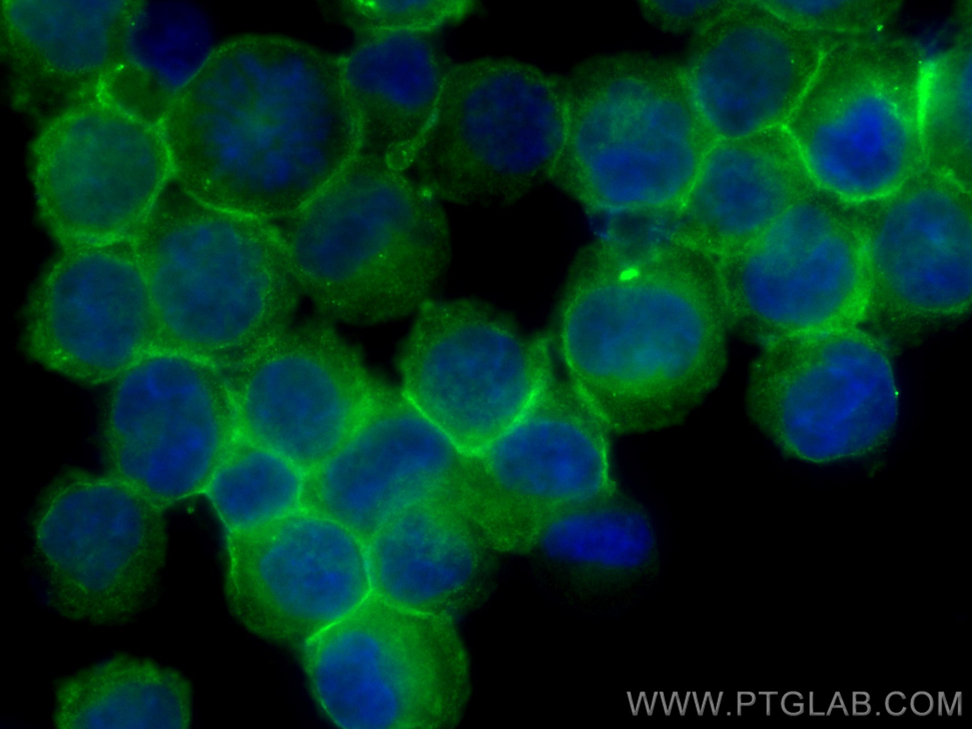Immunofluorescence (IF) / fluorescent staining of K-562 cells using CoraLite®488-conjugated IFITM1-Specific Monoclonal (CL488-60074)