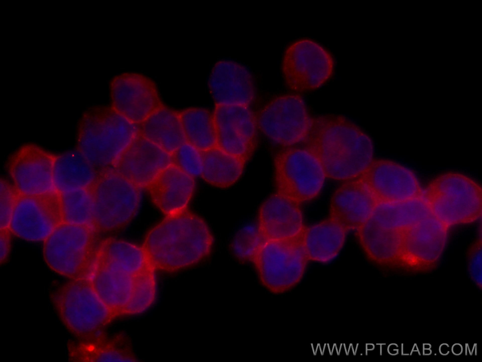 Immunofluorescence (IF) / fluorescent staining of K-562 cells using CoraLite®594-conjugated IFITM1-Specific Monoclonal (CL594-60074)