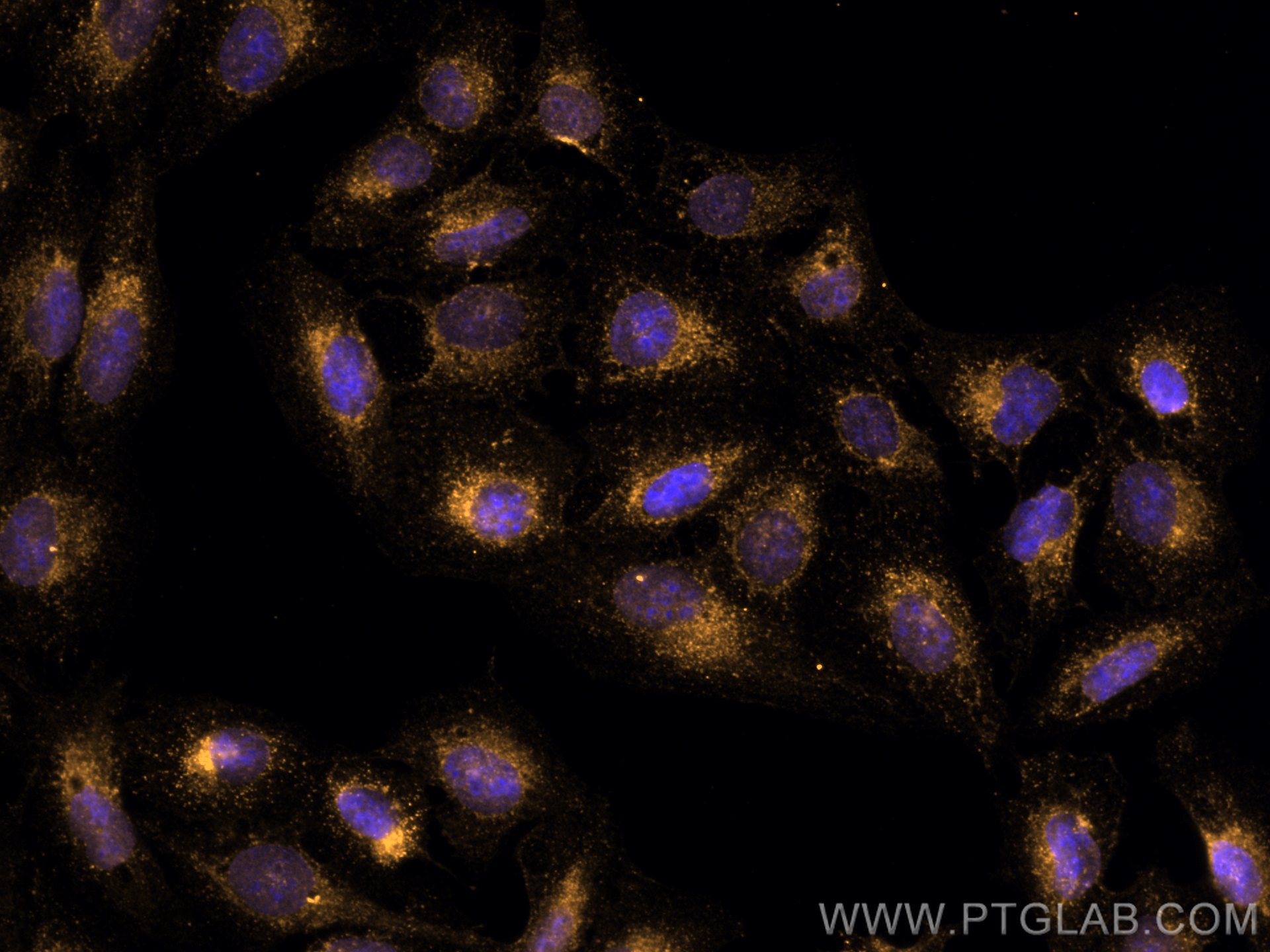 Immunofluorescence (IF) / fluorescent staining of U2OS cells using CoraLite®555-conjugated IFITM2/3 Monoclonal antibo (CL555-66081)