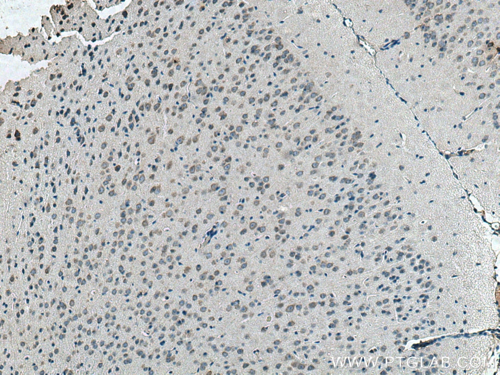 Immunohistochemistry (IHC) staining of mouse brain tissue using IFITM2 Polyclonal antibody (12769-1-AP)