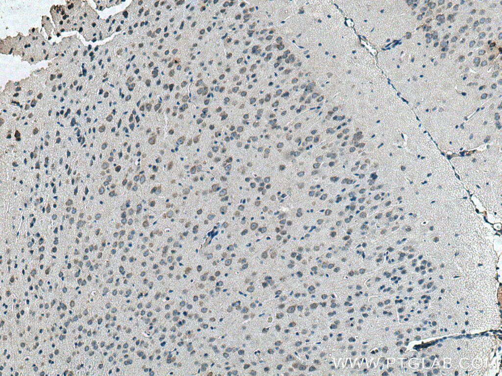 Immunohistochemistry (IHC) staining of mouse brain tissue using IFITM2 Polyclonal antibody (12769-1-AP)