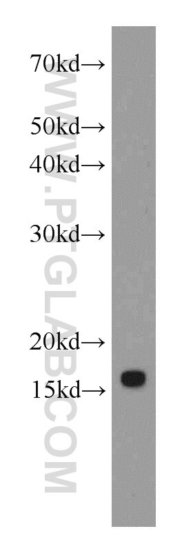 WB analysis of HepG2 using 66137-1-Ig