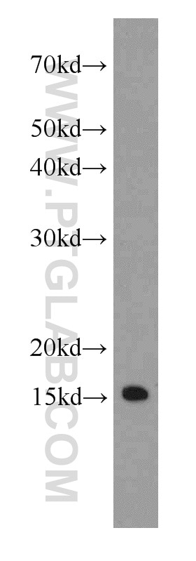 WB analysis of MCF-7 using 66137-1-Ig