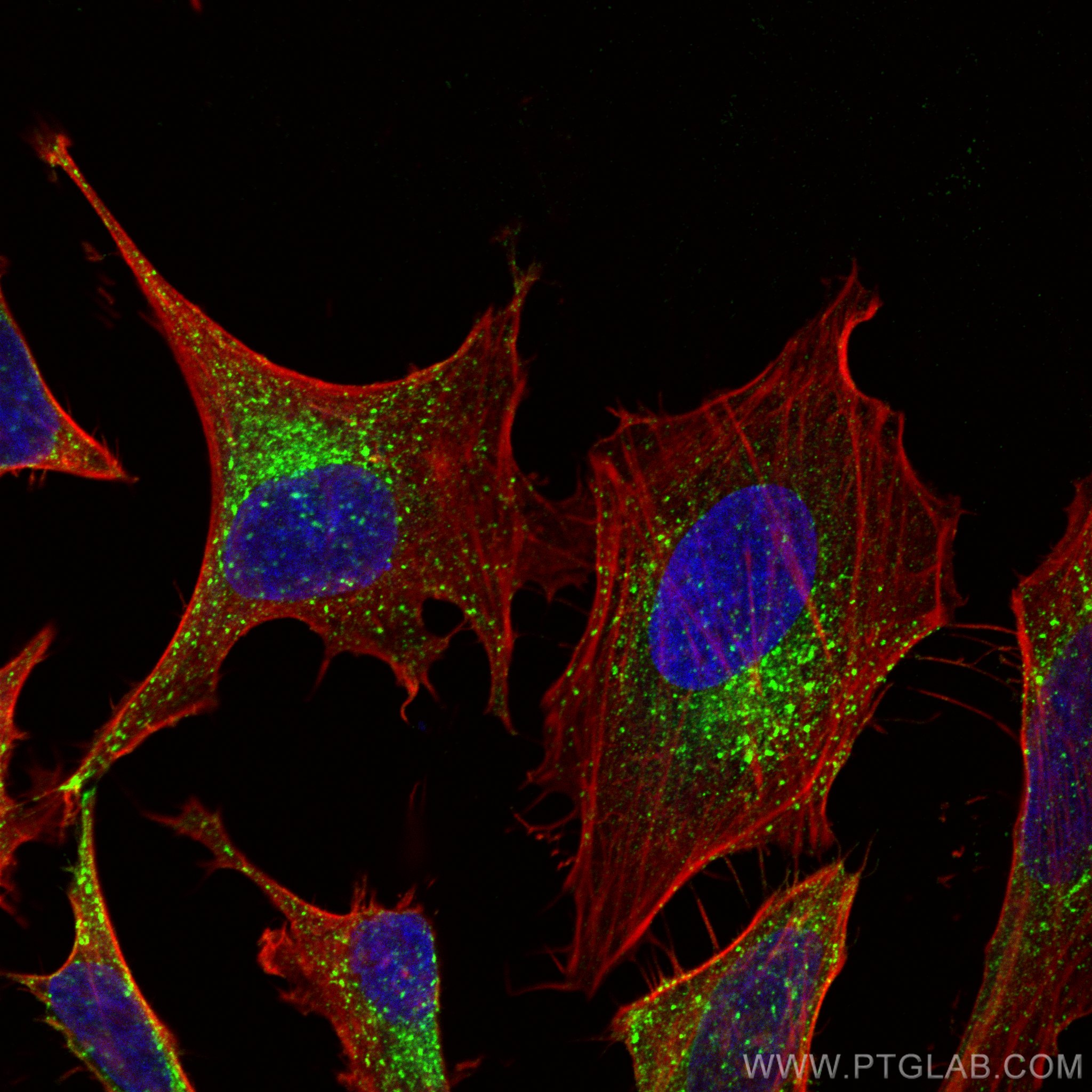 Immunofluorescence (IF) / fluorescent staining of HeLa cells using IFITM3 Polyclonal antibody (11714-1-AP)