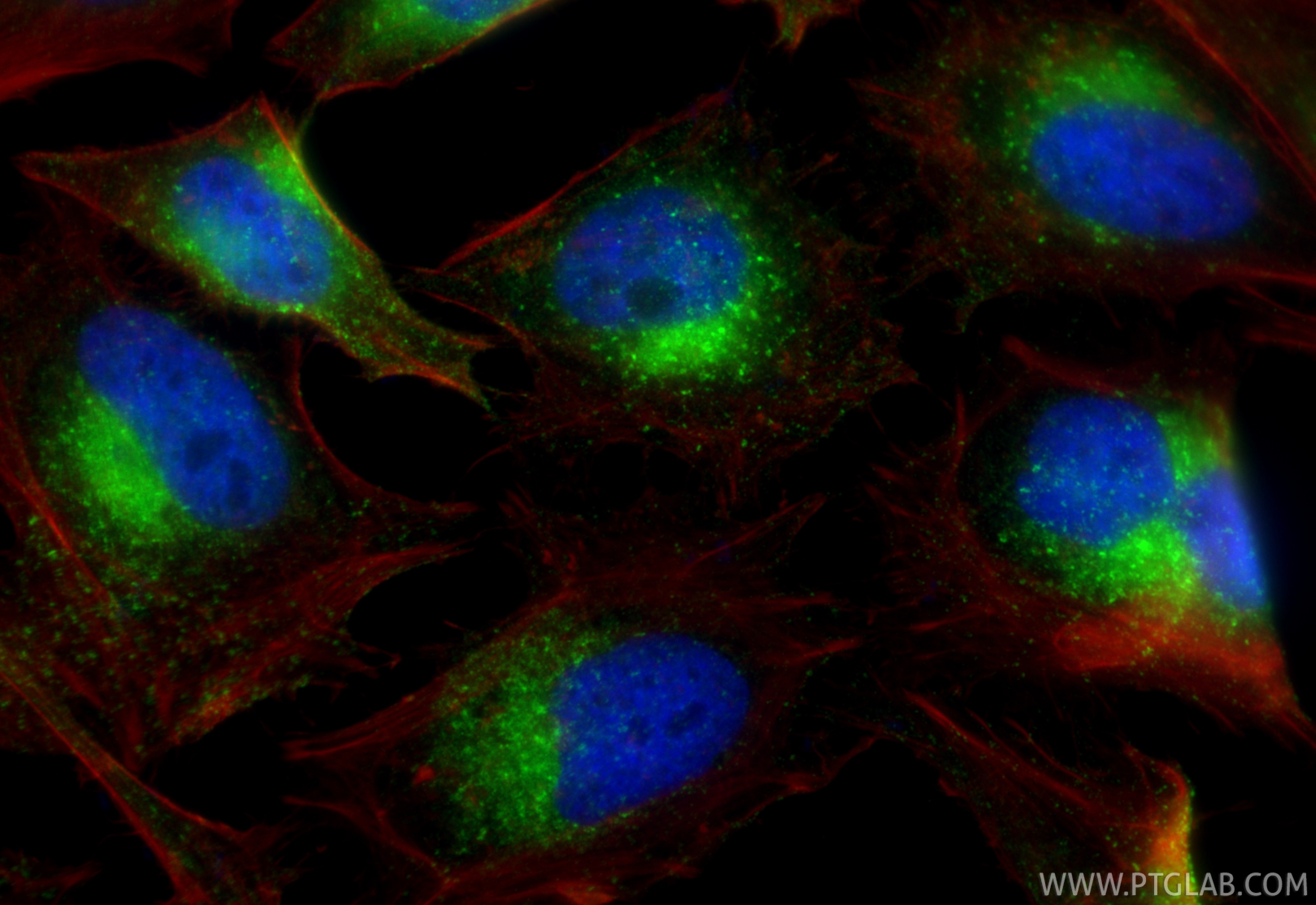 Immunofluorescence (IF) / fluorescent staining of HeLa cells using IFITM3 Polyclonal antibody (11714-1-AP)