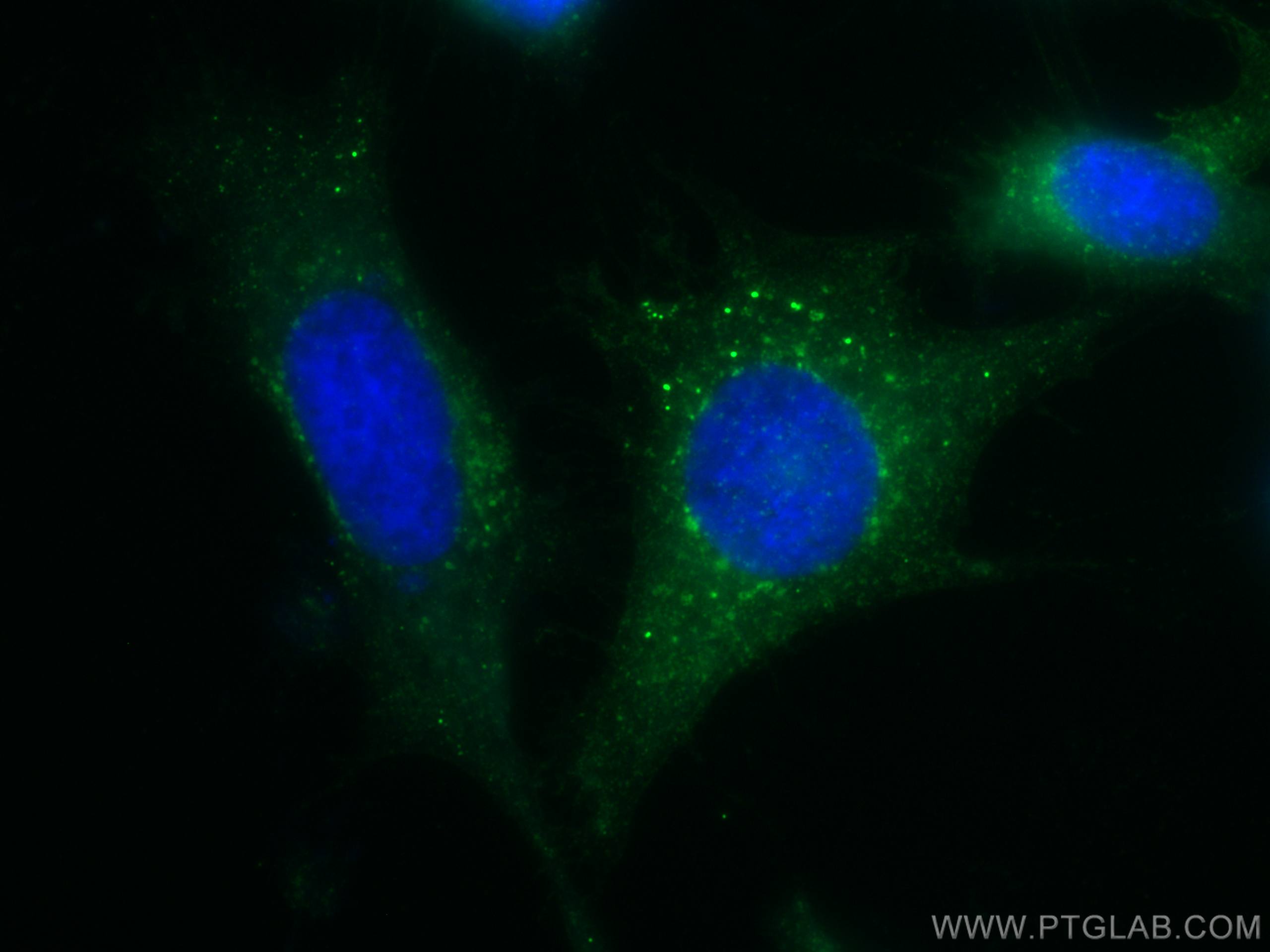 Immunofluorescence (IF) / fluorescent staining of HeLa cells using CoraLite® Plus 488-conjugated IFITM3 Polyclonal an (CL488-11714)