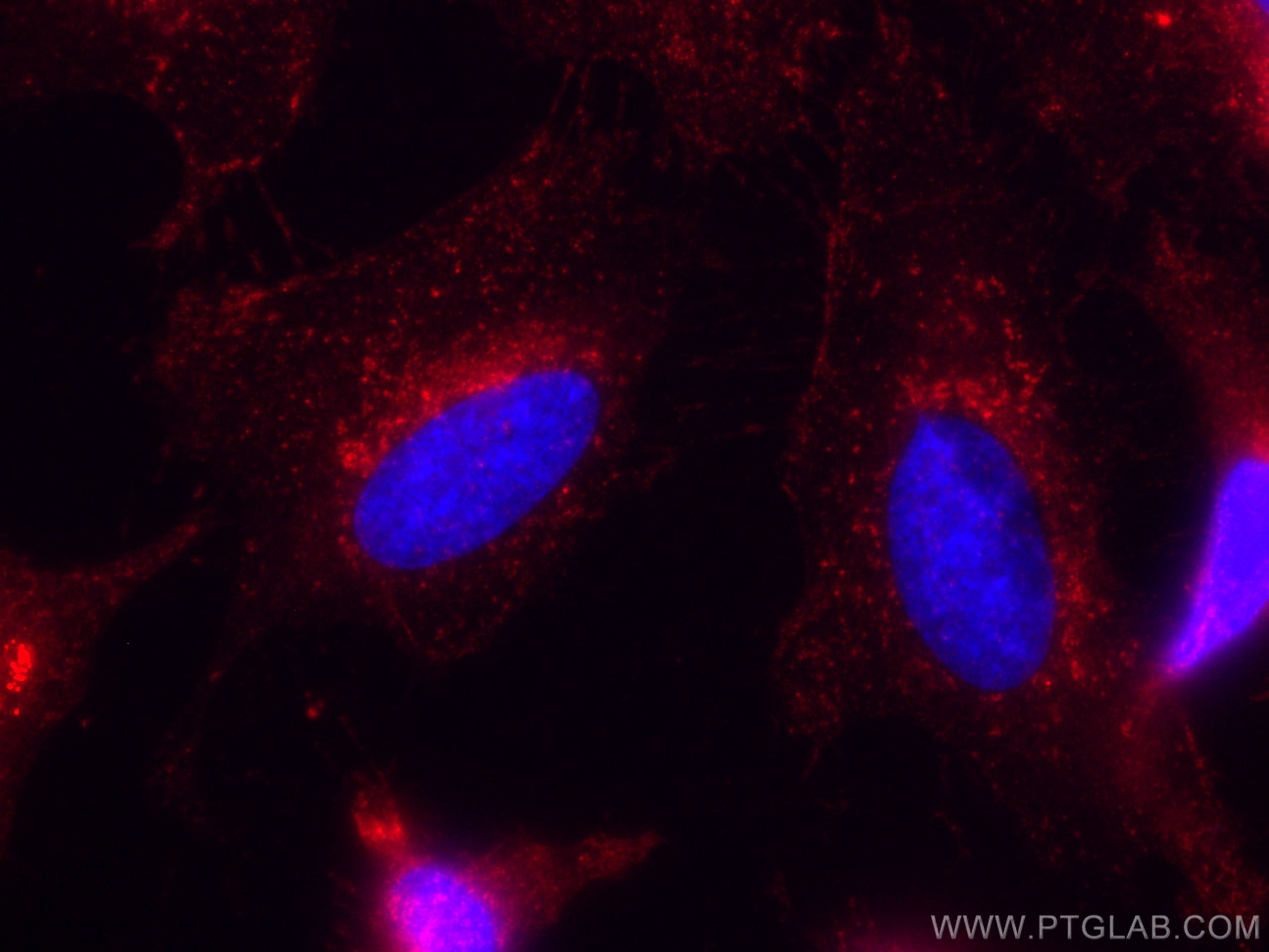Immunofluorescence (IF) / fluorescent staining of HeLa cells using CoraLite®594-conjugated IFITM3 Polyclonal antibody (CL594-11714)