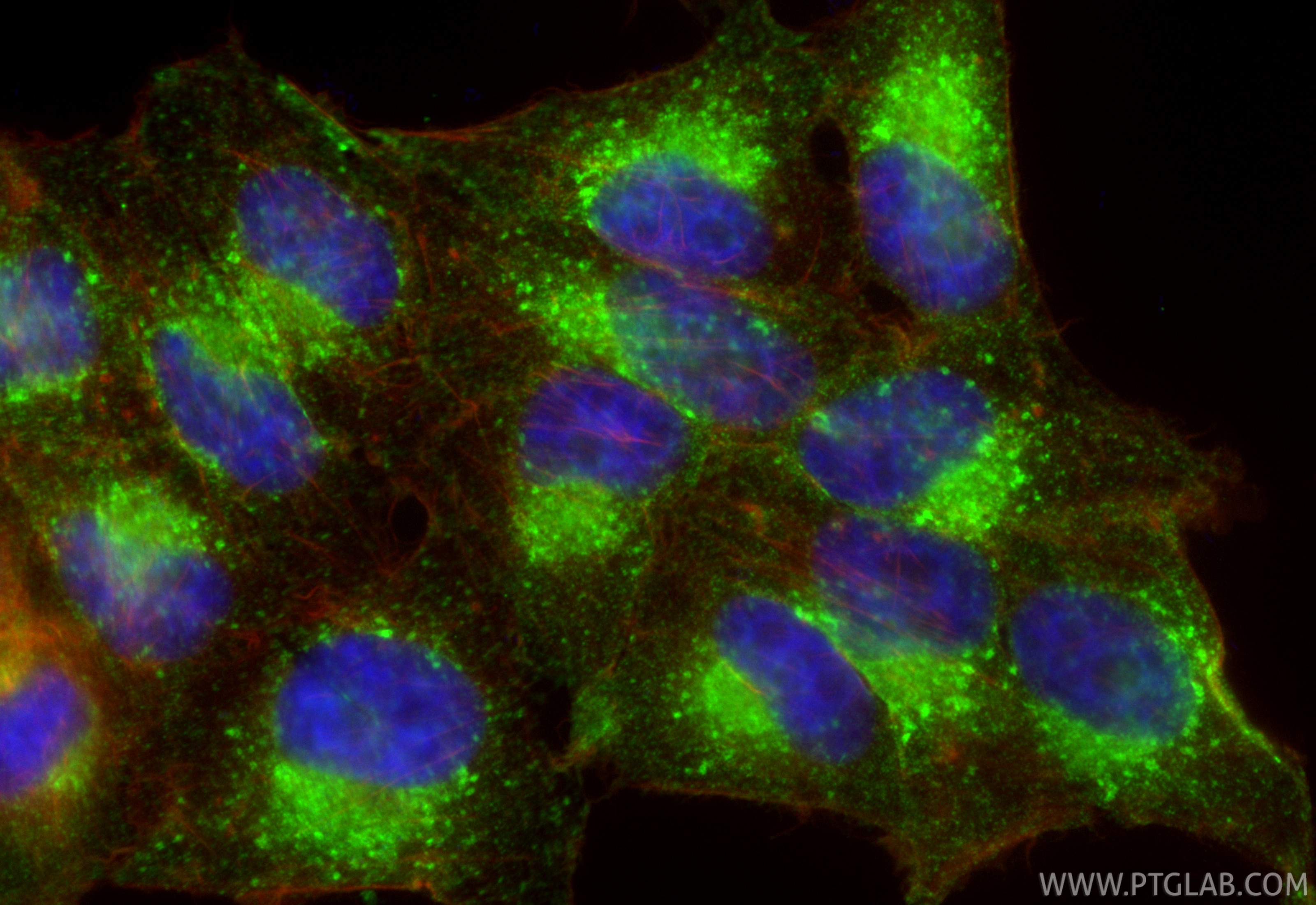 IF Staining of HepG2 using RMX00071 Immunofluorescence (IF) / fluorescent staining of HepG2 cells using Multi-rAb® IFITM3 Multi-Recombinant antibody (RMX00071)
