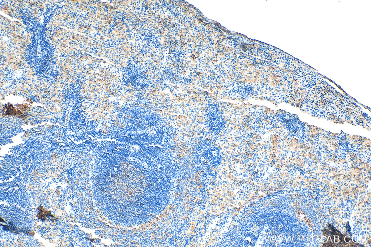 Immunohistochemistry (IHC) staining of rat spleen tissue using IFN Gamma Polyclonal antibody (30293-1-AP)