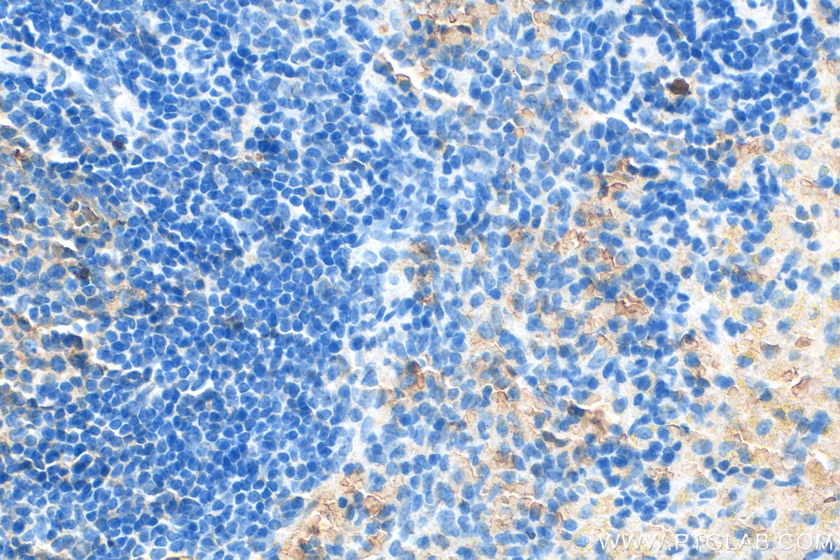 Immunohistochemistry (IHC) staining of rat spleen tissue using IFN Gamma Polyclonal antibody (30293-1-AP)