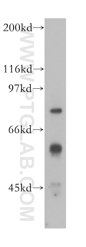 IFNAR1 Polyclonal antibody