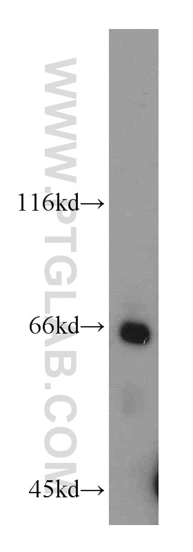 IFNAR2 Polyclonal antibody